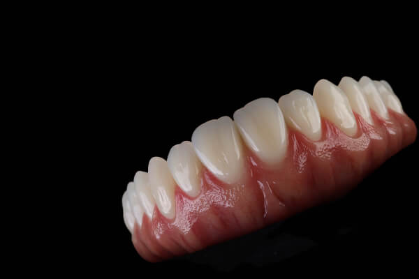 implantes dentários rafael rosalino odontologia