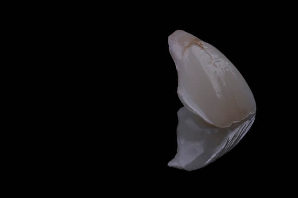 facetas de porcelana rafael rosalino odontologia